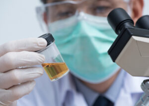 doctor checking urine